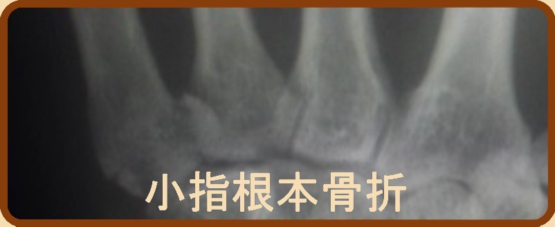 RW΁@j@T荜ꕔ܂ւ̃N