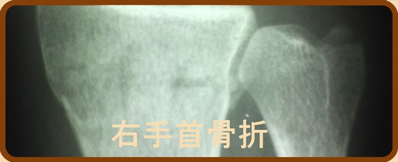 TX΁@j@ER[X܂ւ̃N