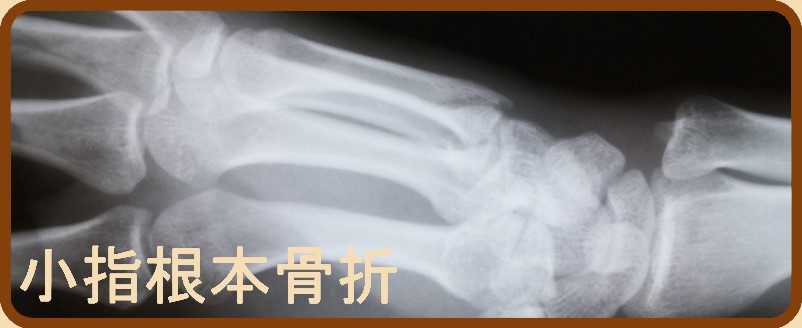 SO΁@j@ET荜ꕔ܂ւ̃N