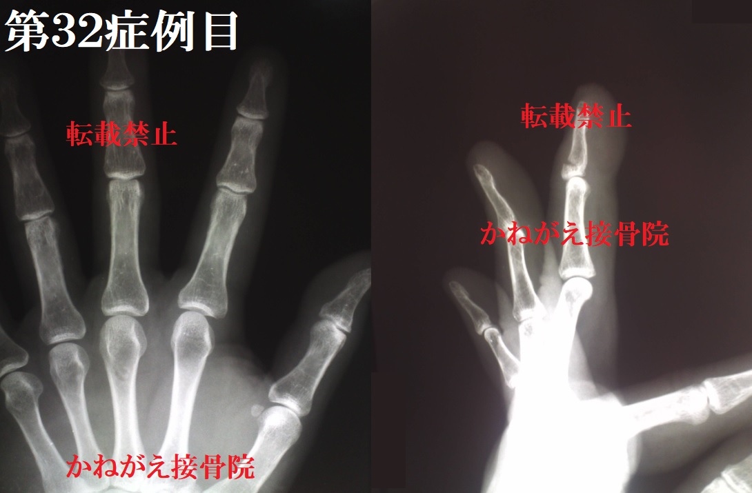RQǗ