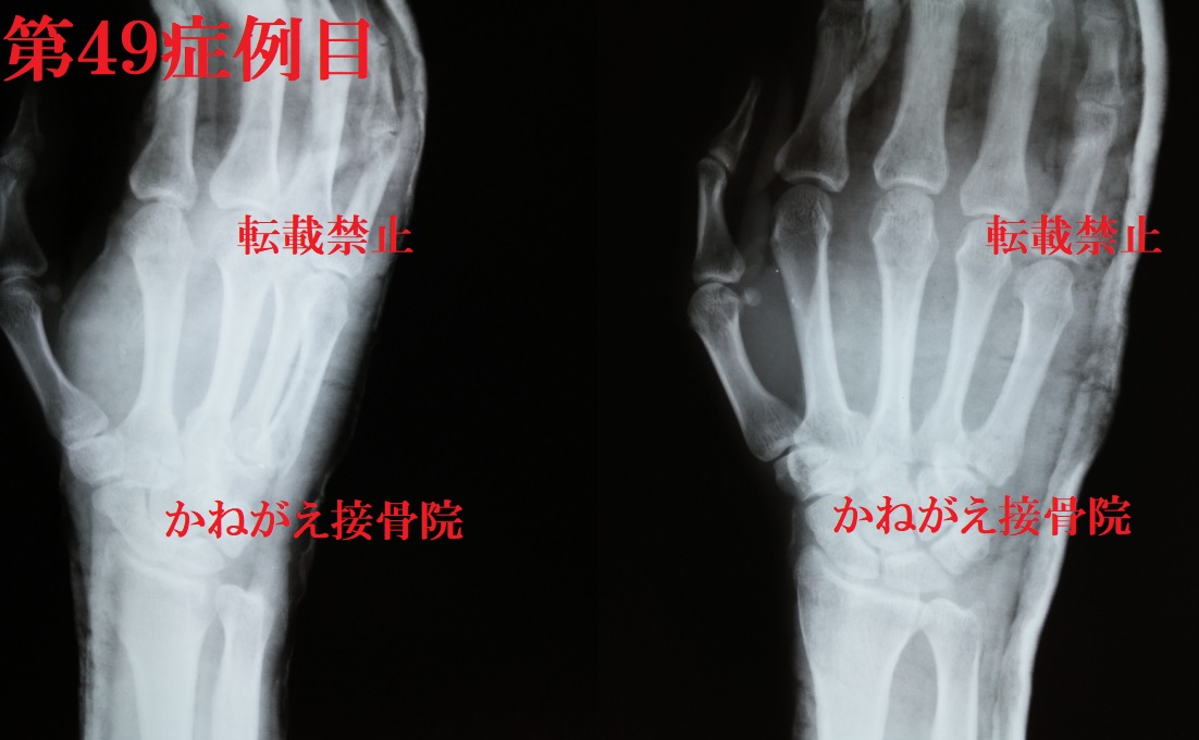 SXǗڂQ