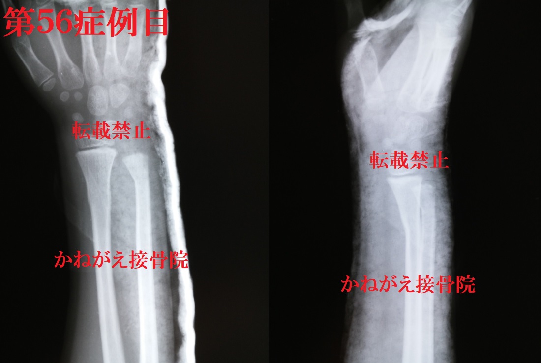 TUǗڂQ